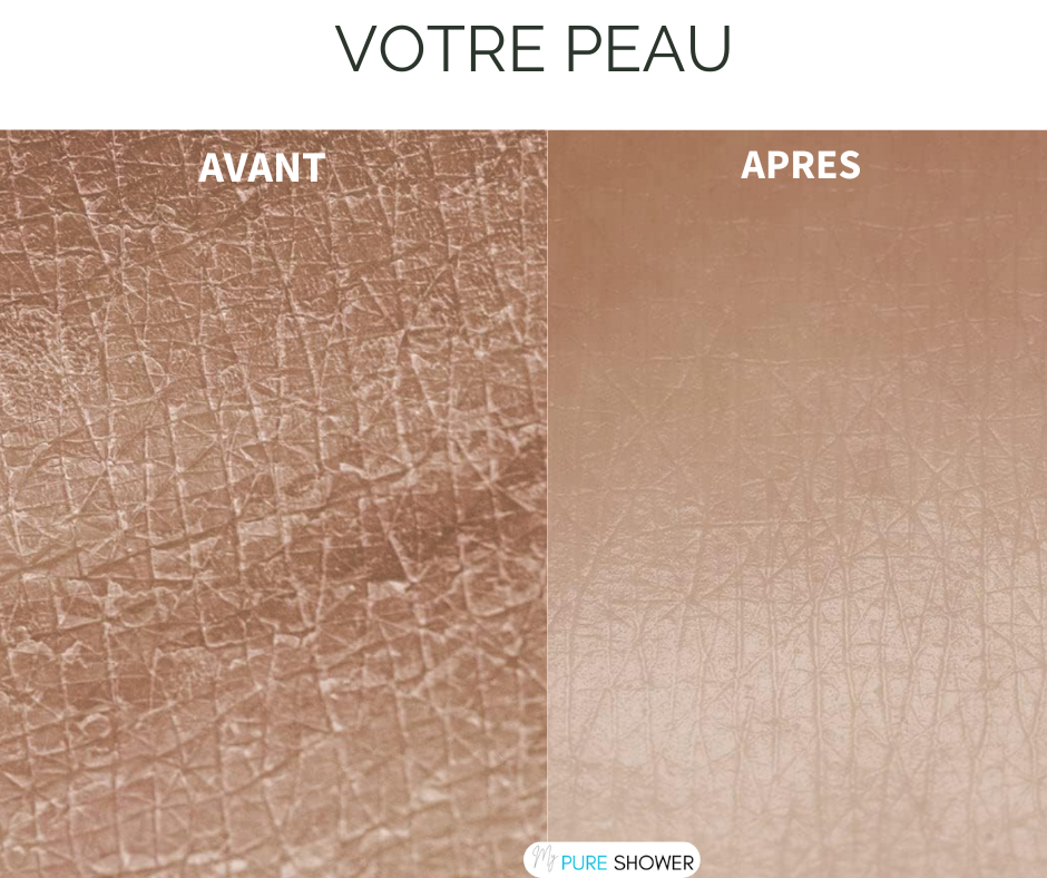 photo d'un visuel d'une phoot de la peau avant et après